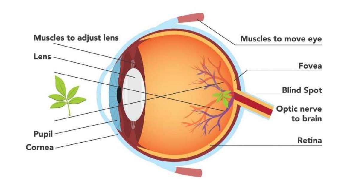 Implantable Lens Operations: Faced With Such A Number Of Choices