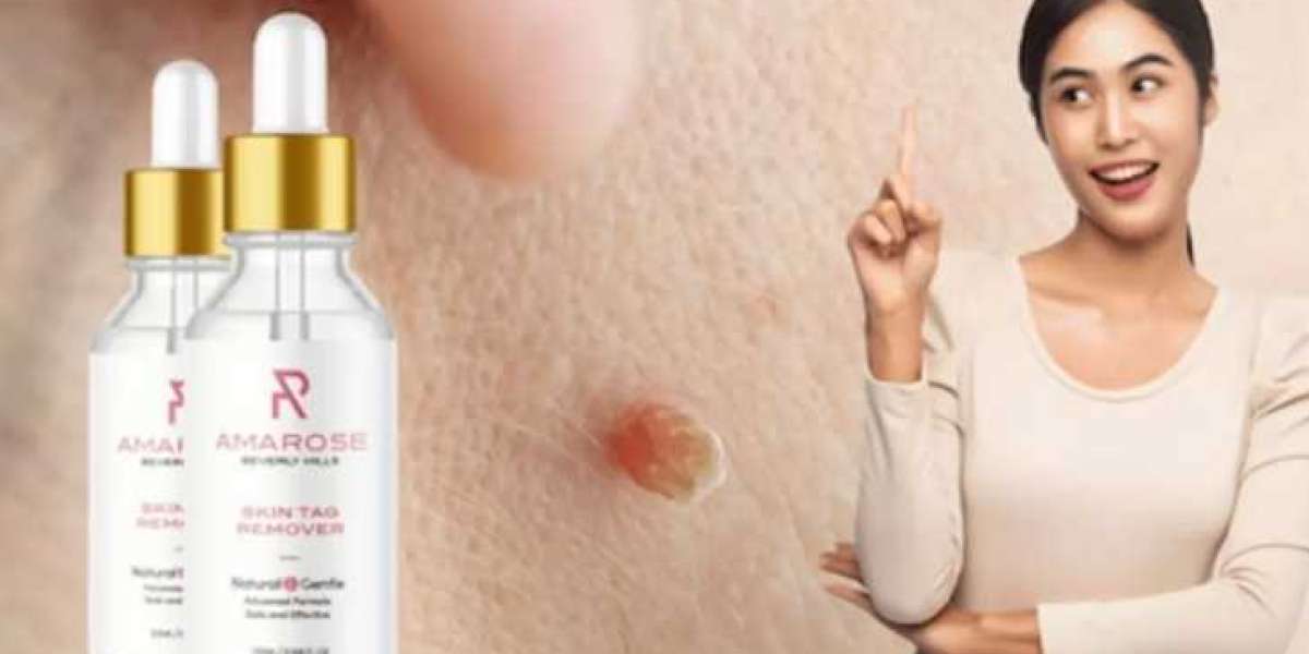 Amarose Skin Tag Remover Reviews (Shocking Scam Warning!) 2023 Update