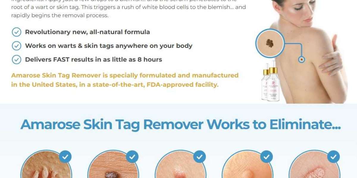 10 Perfect Skin Tag Remover