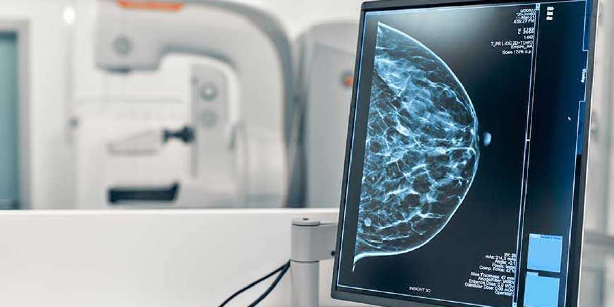 Mammography System Market Industry Revenue, Statistics, Forecast by Emergen Research