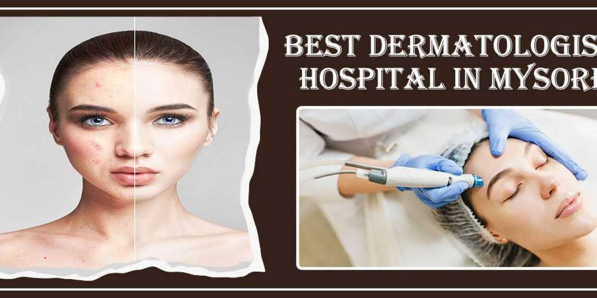 Best Dermatologist Hospital in Bangalore | Famous