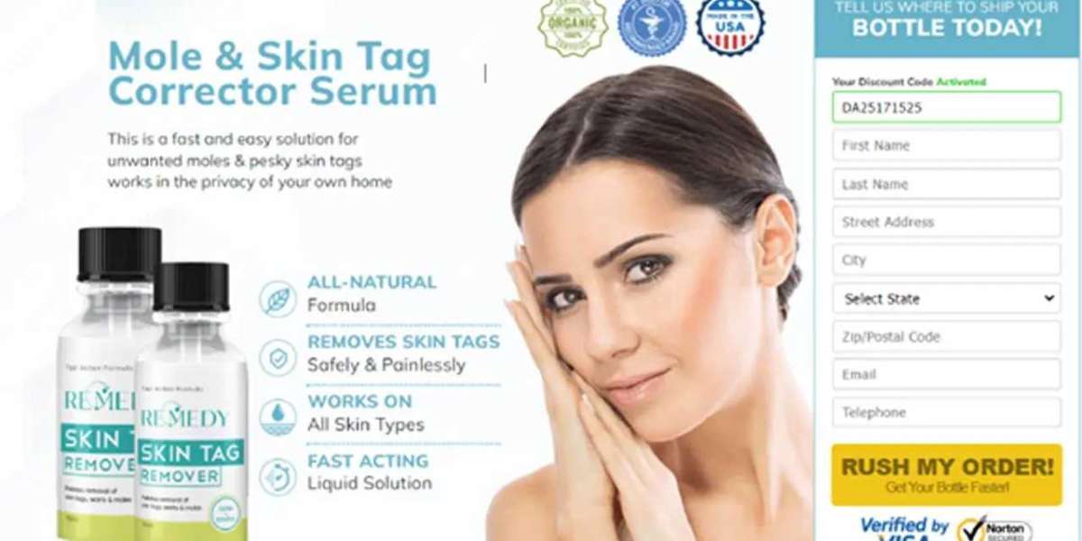 https://www.facebook.com/Remedy.Skin.Tag.Remover.Buy/