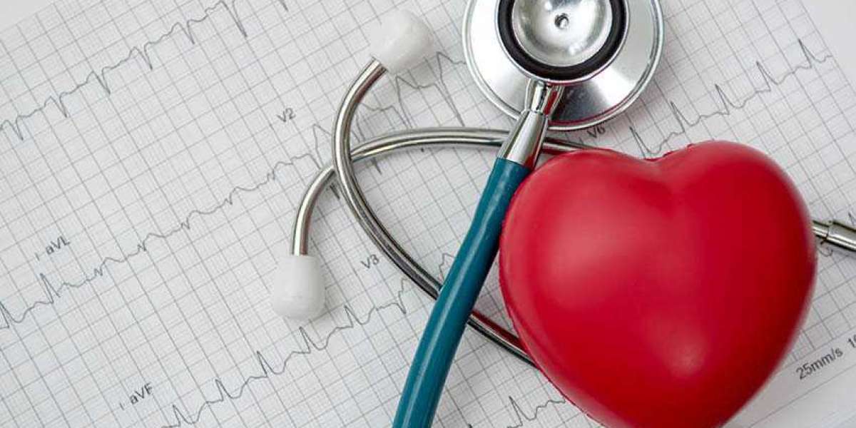 The Essential Guide to Choosing the Right Heart Checkup Packages