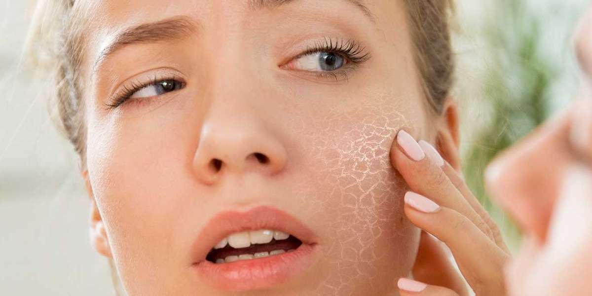 Common Skincare Mistakes to Avoid with Skinlite Cream