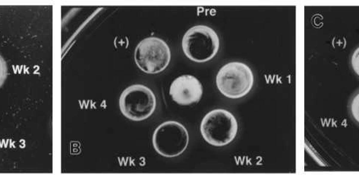 Novel Agar Gel Precipitin Tests for Viral Antigen Detection