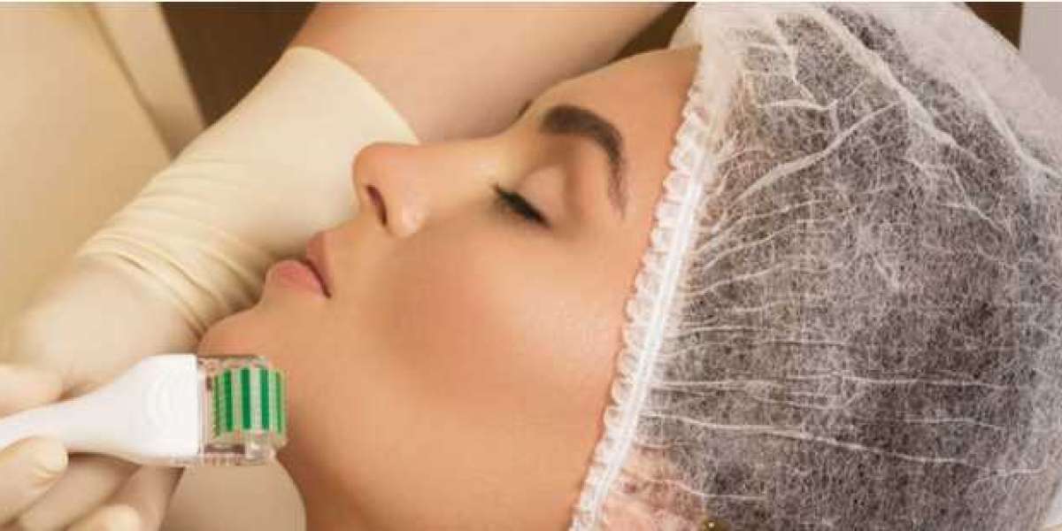 Dermaroller Treatment in Mumbai: A Safe and Effective Solution for Skin Rejuvenation