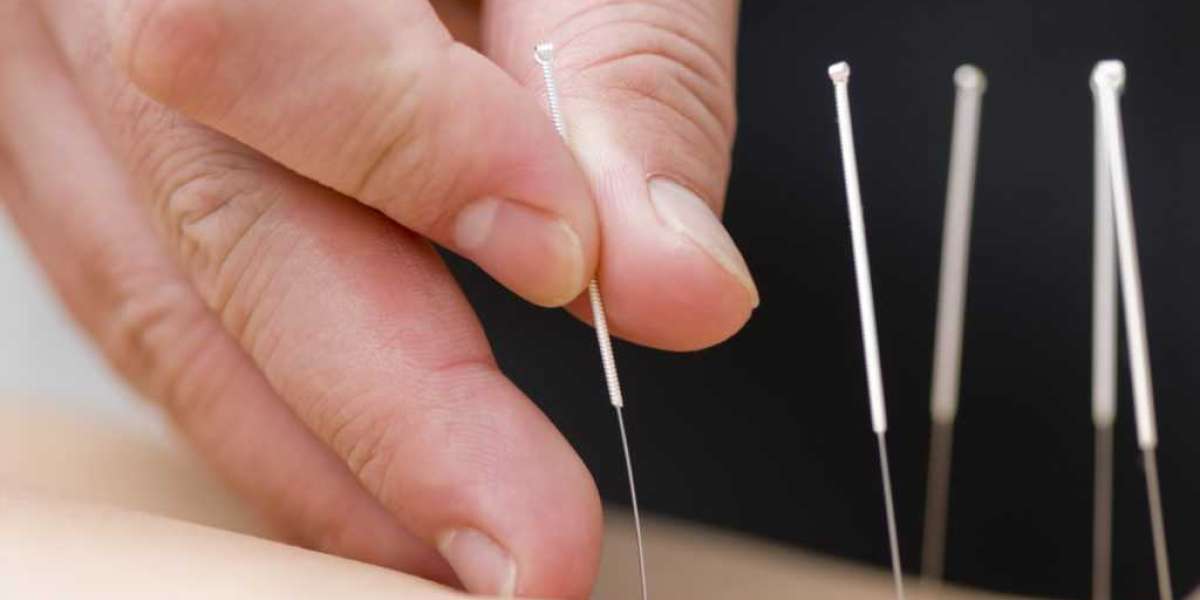 Best Acupuncture for IVF Support | Top Fertility Services in NYC - Grand Madison Acupuncture