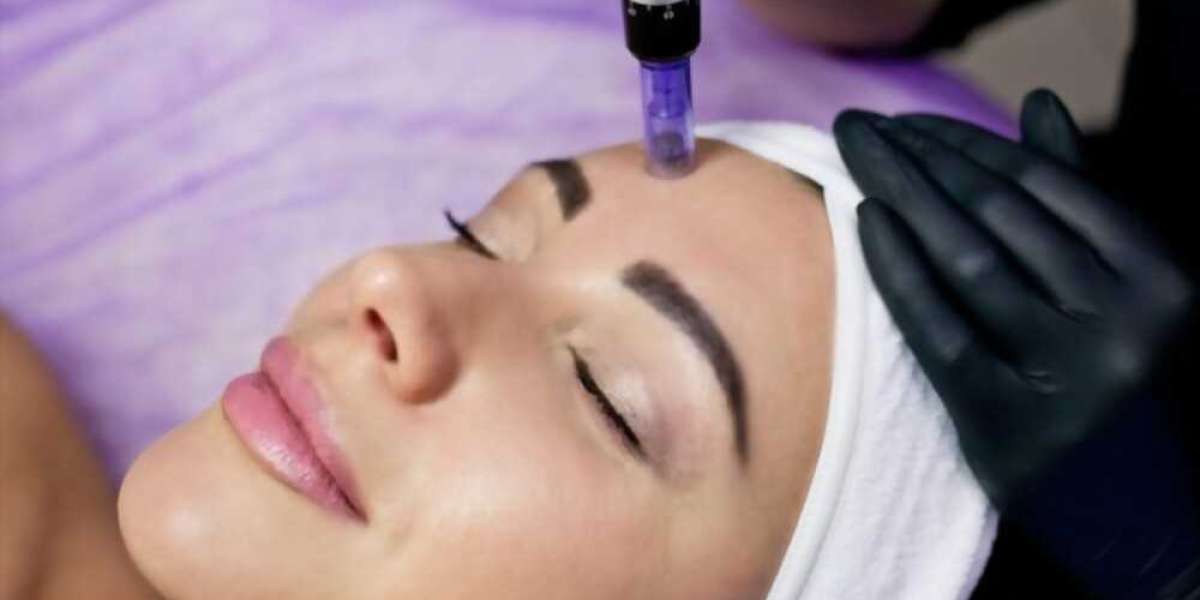 Why Micro-Needling in Novi is the Ultimate Skin Rejuvenation Treatment