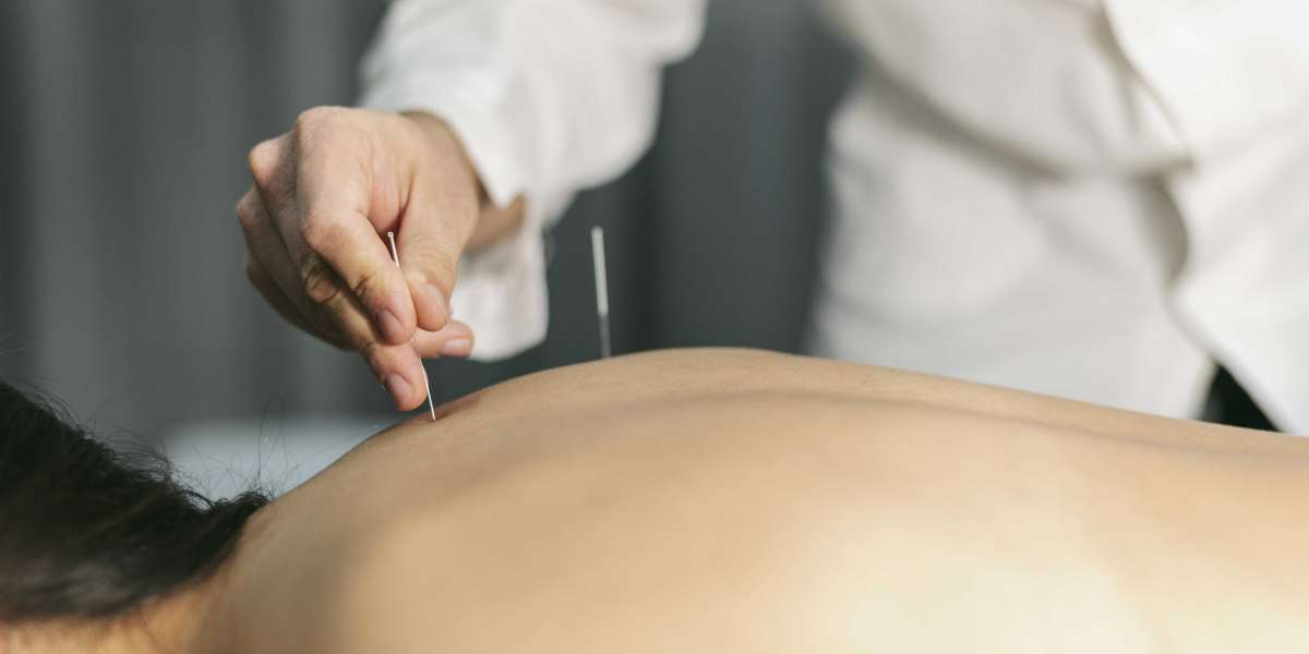 Experience Holistic Healing with Expert Acupuncture in Newport Beach at Hannah Integrative Health