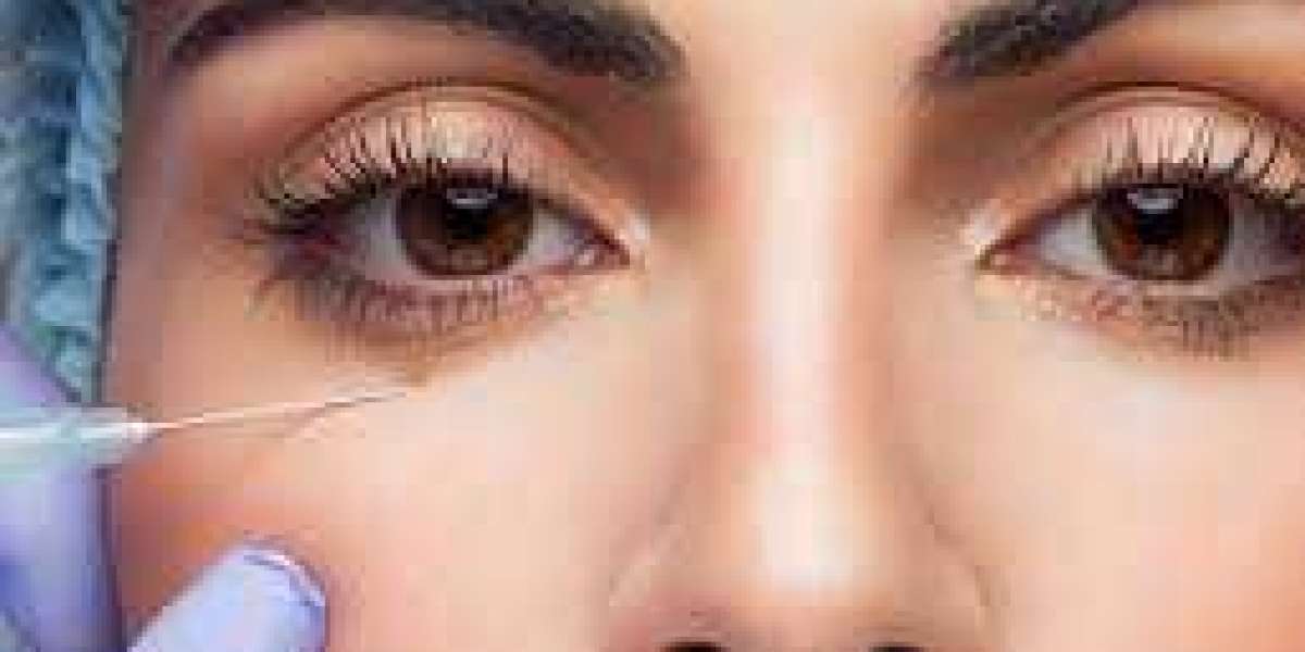 Under Eye Fillers in Dubai – The Secret to Brighter, Youthful Eyes?