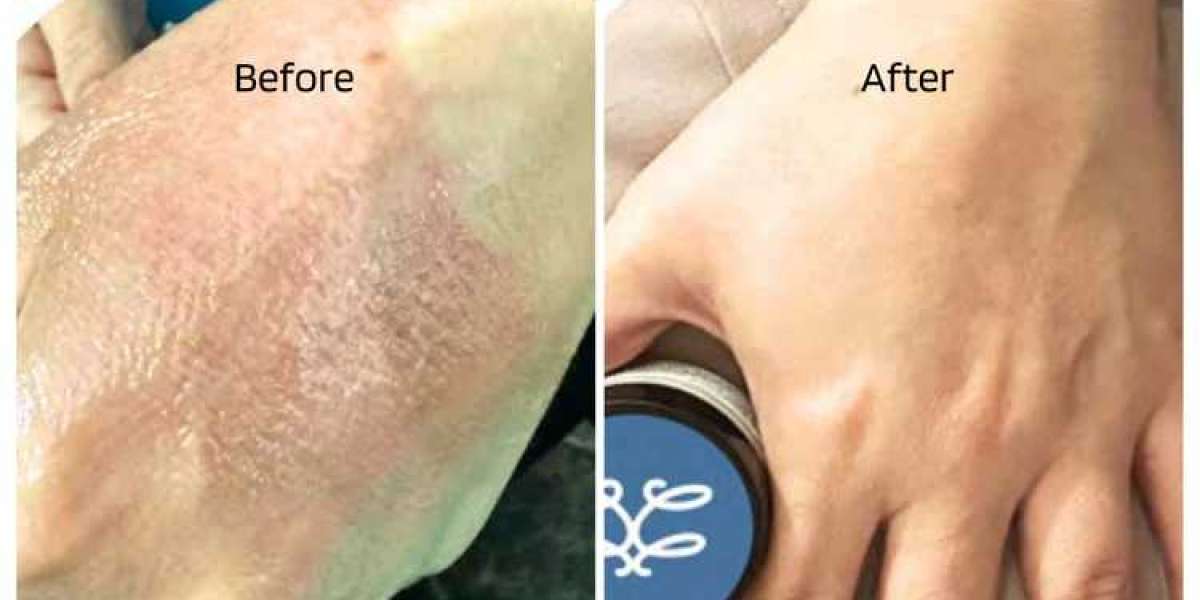 Discover the Power of Natural Body Creams Today