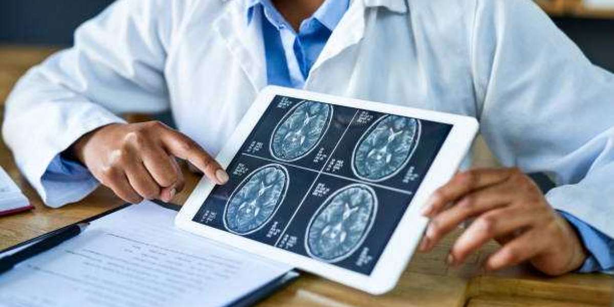 Accurate Epilepsy Diagnosis by Southern Neurology Miranda
