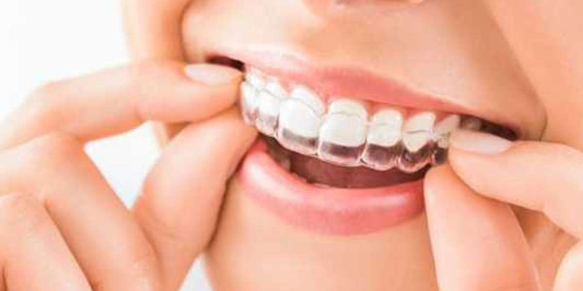 The Importance of Dental X-Rays for Oral Health