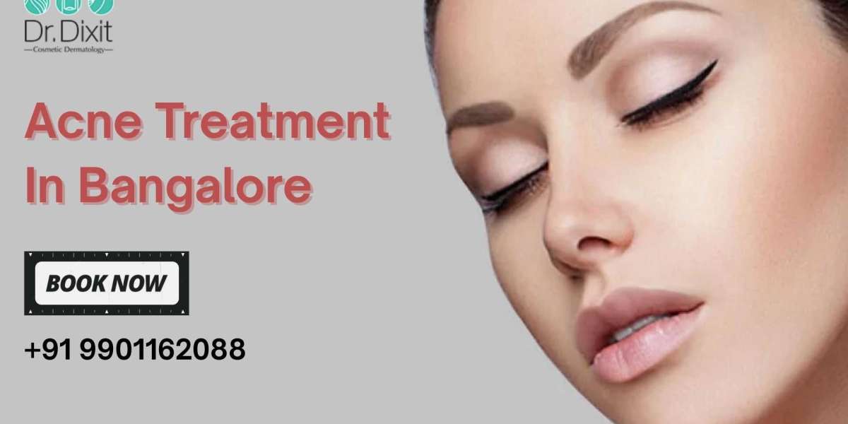 Tips To Take Care of Acne in Summer