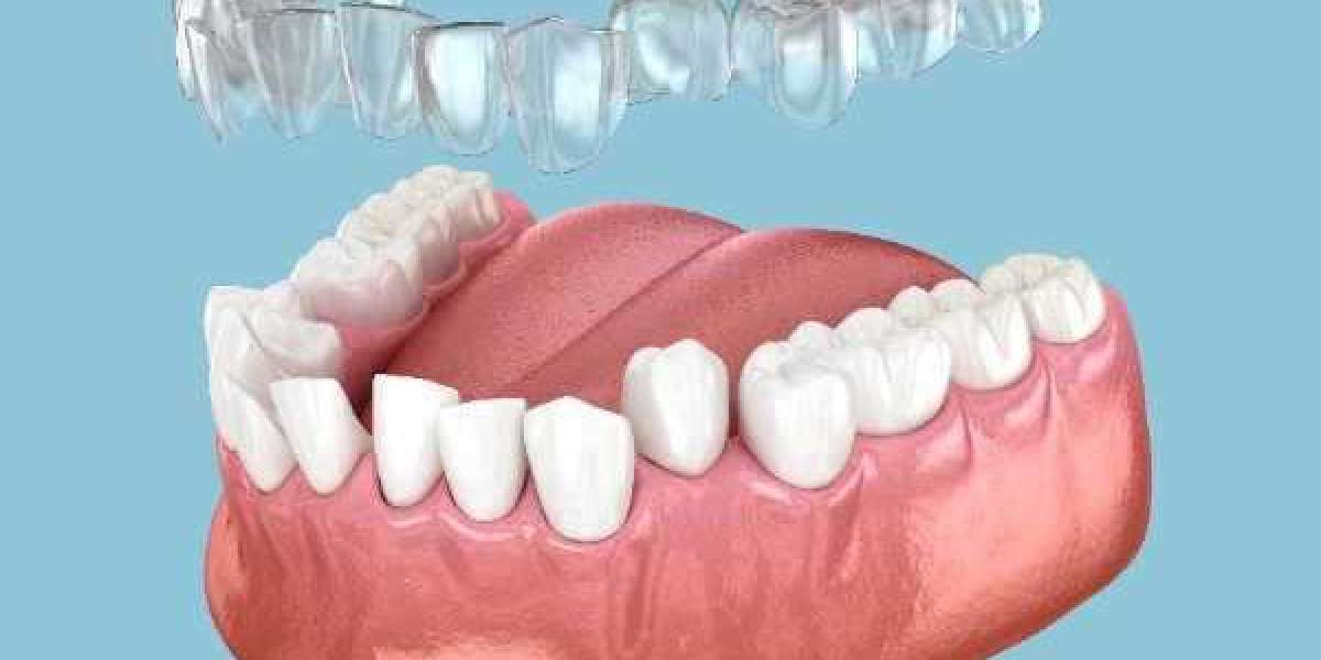 Invisalign Orthodontic Care with Personalised Excellence