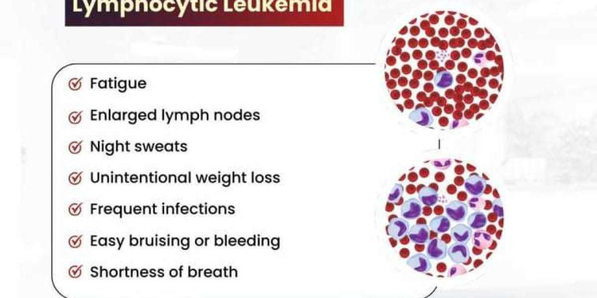 Expert Care for Leukemia: Dr. S.K. Gupta, Renowned Leukemia Specialist
