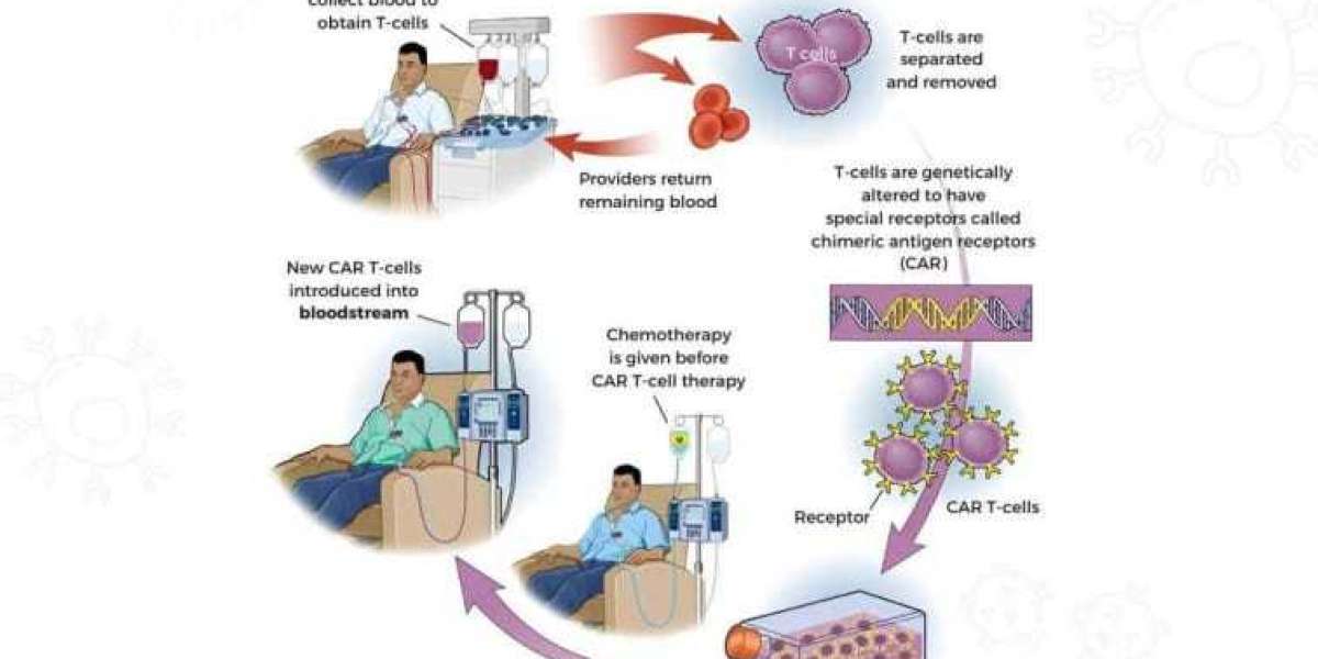 CAR T Cell Therapy in Hyderabad – Dr. S.K. Gupta
