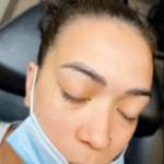 Eyebrow Tattoo Removal Tri Cities