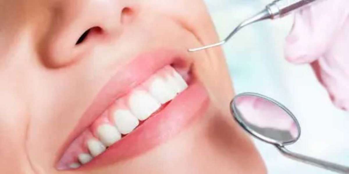 What to avoid after teeth whitening treatment