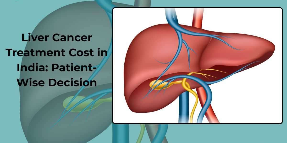 Liver Cancer Treatment Cost in India: Patient-Wise Decision