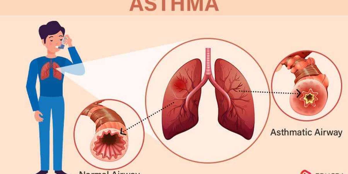 Innovative Asthma Treatments in Varanasi with Dr. J.K. Samaria