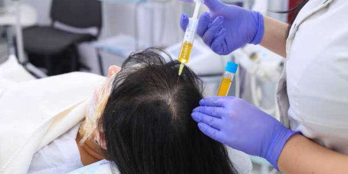 PRP for Postpartum Hair Loss: A Silent Trend Among Abu Dhabi’s New Mothers