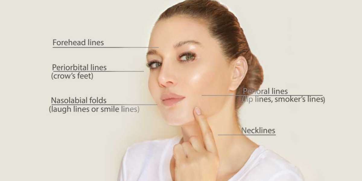 Cheek fillers Royal Oak