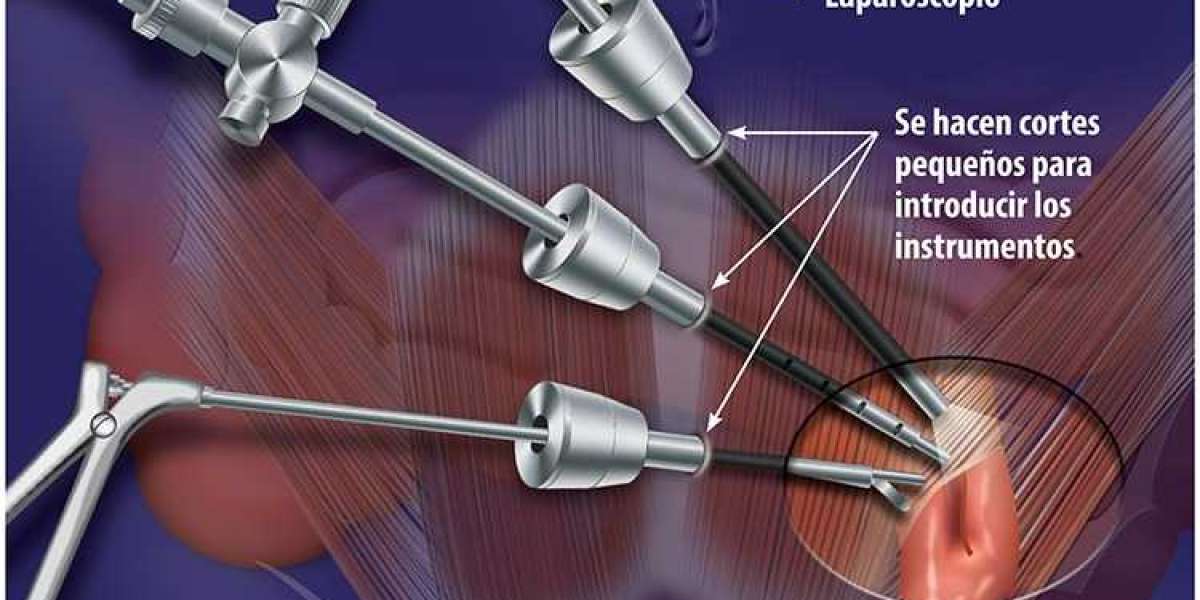 Laparoscopes Market Size, Global Insights 2021–2031