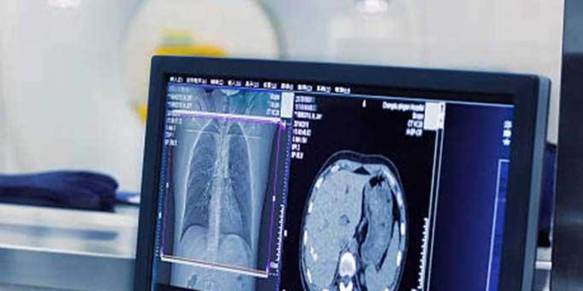 Unlocking Precision Care: Chiropractic with X-Ray Technology