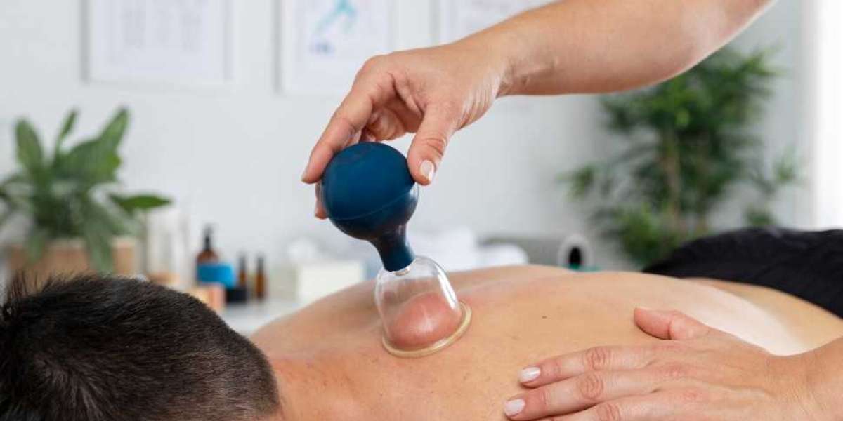 The Perfect Balance: Merging Dry Needling with Chinese Medicine for Holistic Healing