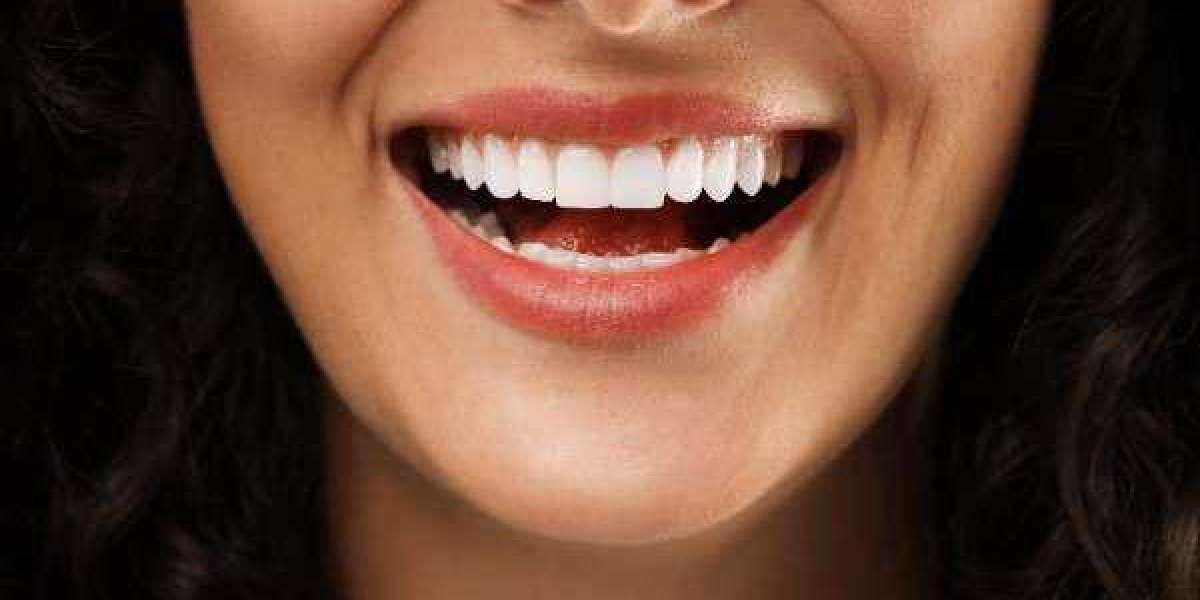 Maintain That Glow: 5 Tricks for Longer Lasting White Teeth
