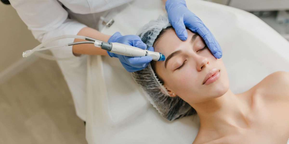 Laser Hair Removal Near Me: Discover the Benefits with BeautyAesthetics