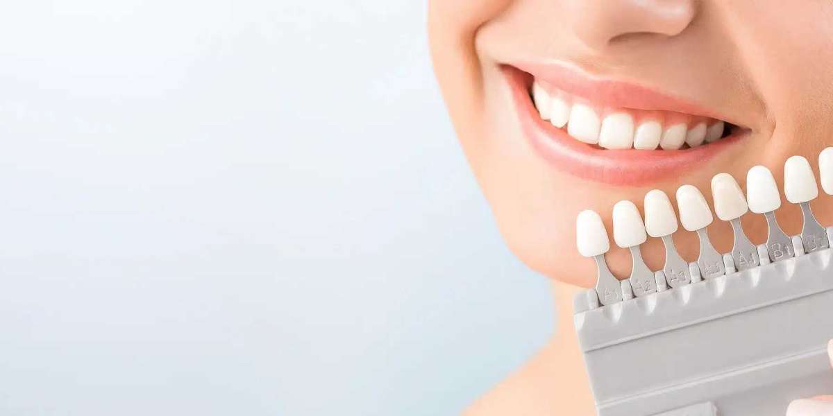 Is It Safe to Pair Teeth Whitening with Other Procedures?