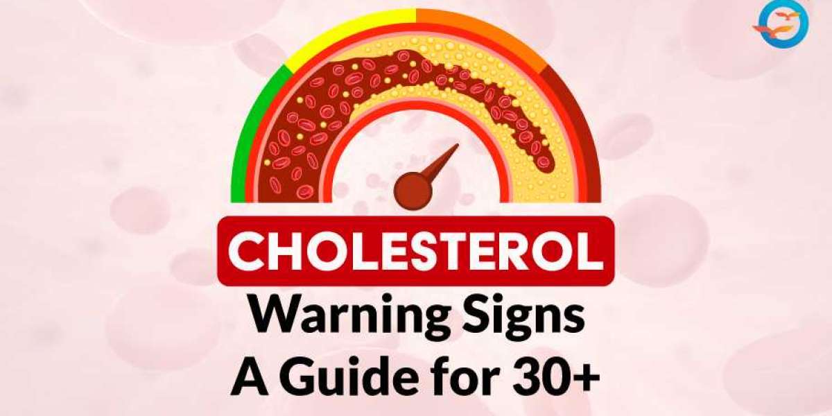 What Are the Warning Signs of High Cholesterol After 30?