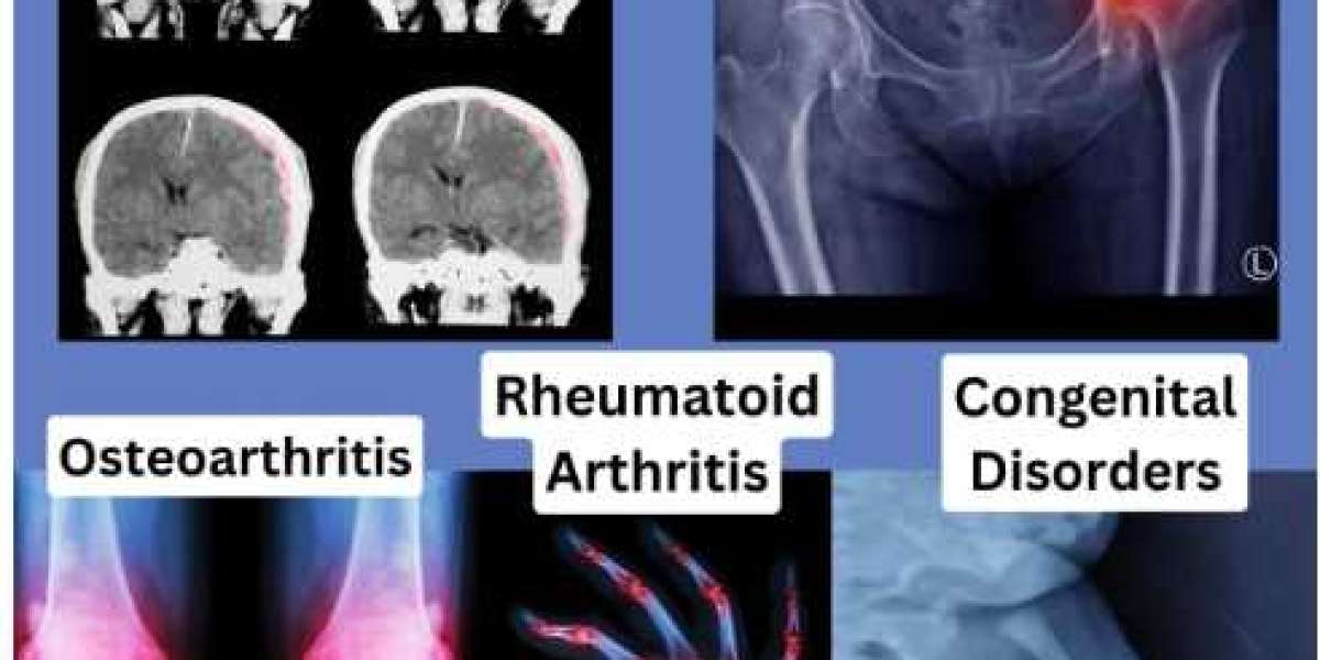 Best Knee Arthroscopy Surgery in Kolkata – Get Advanced Keyhole Surgery by Dr. Reet Mukhopadhyay for Effective Knee Pain