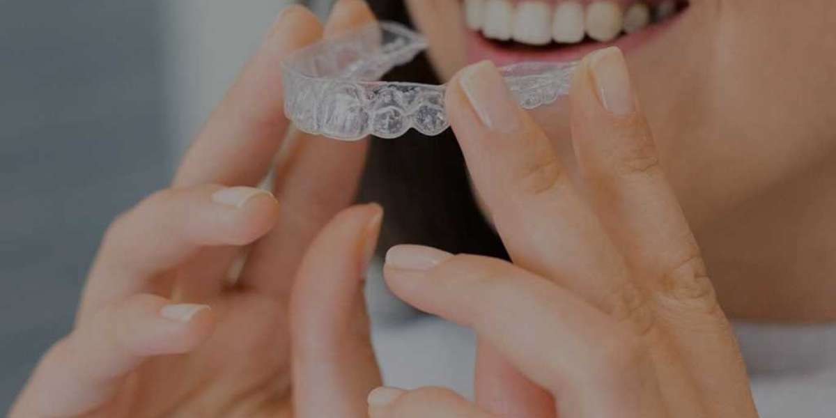 Bonds Dental – Enhance Your Smile with Delta Park Dental