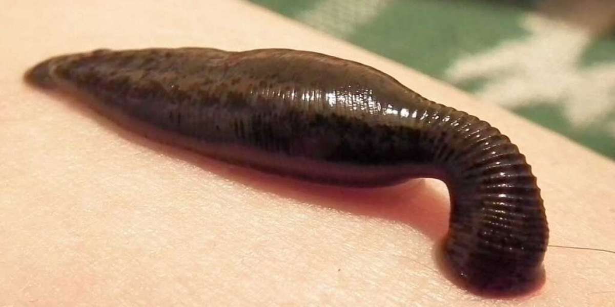 Why Wellness Centers in Mumbai are Adopting Leech Therapy in 2025