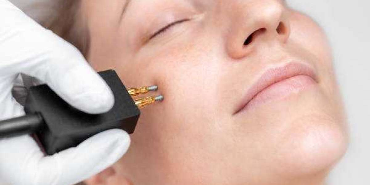 How Incellderm is Redefining Beauty Standards