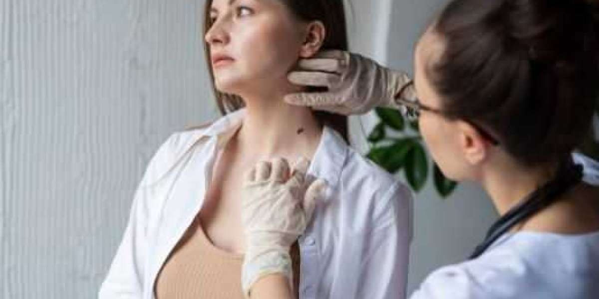 Skin Tag Removal in Pakistan: Methods, Costs, and Aftercare Tips