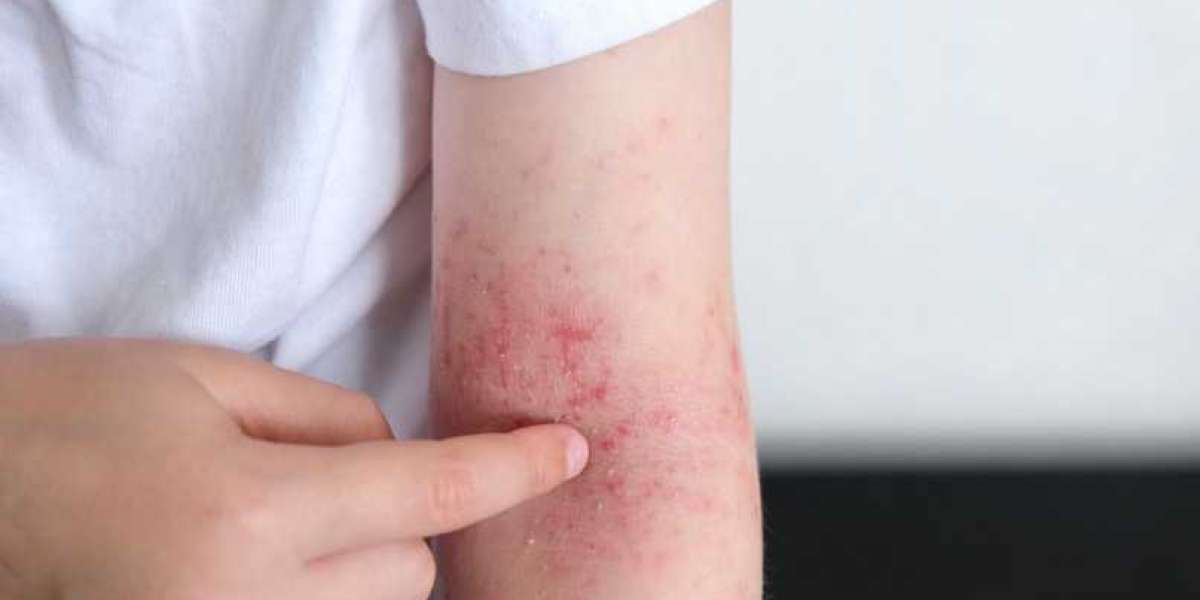 Innovative Stem Cell Therapies for Skin and Autoimmune Conditions