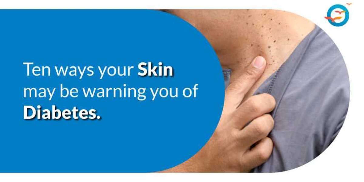 10 Ways Your Skin May Be Warning You of Diabetes