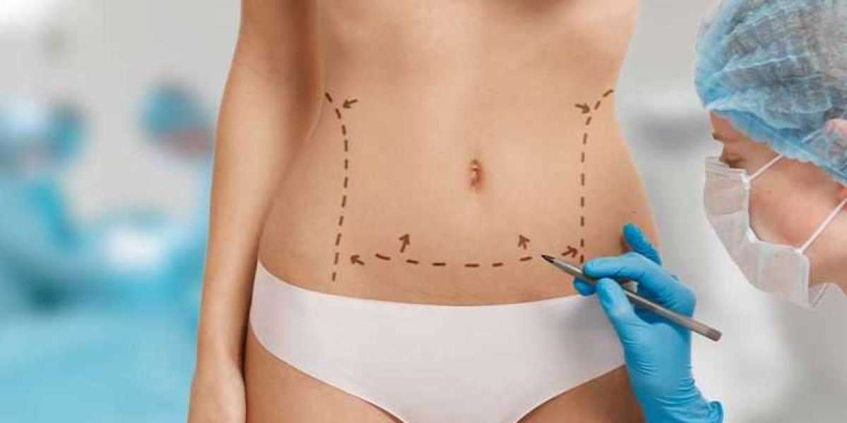 Beyond the Scalpel: Rethinking Liposuction in the Era of Body Empowerment