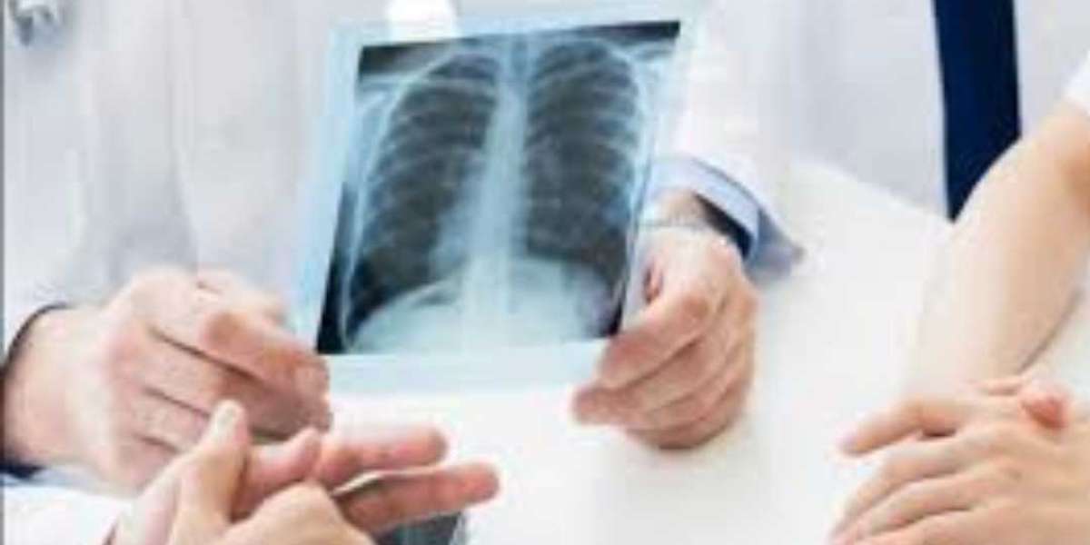 Top-Quality X Ray Lab Near Me: Everything You Need to Know Before You Book