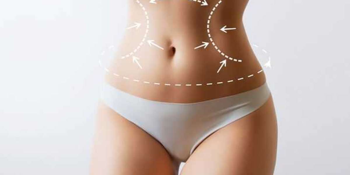 Liposuction Explained: Everything You Need to Know Before Going Under the Knife