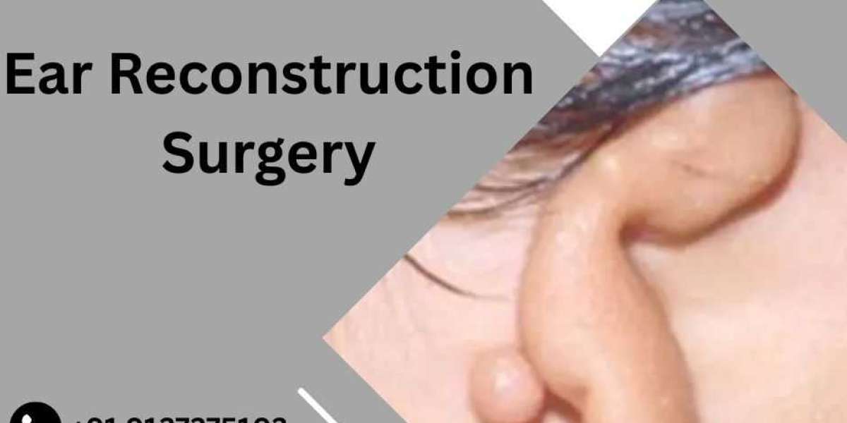 Benefits of Microtia Ear Reconstruction Surgery with Rib Cartilage