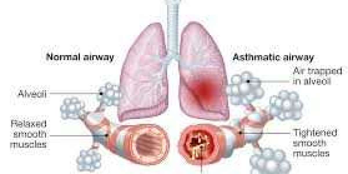 Breathing Through Varanasi’s Festivities: Dr. J.K. Samaria’s Care as an Asthma Doctor