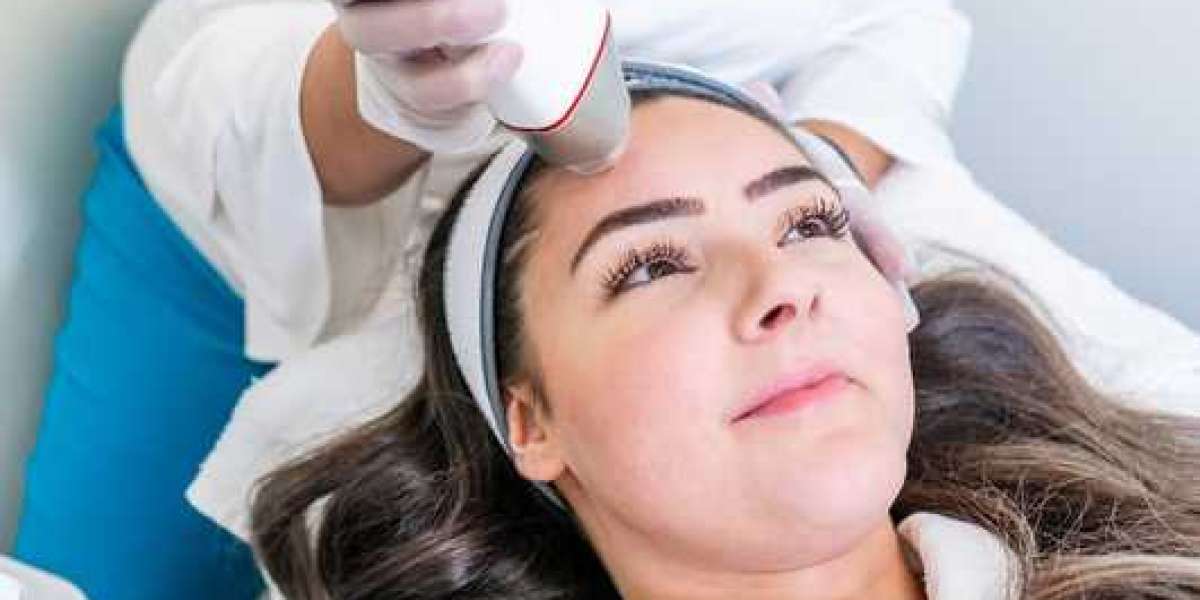Transform Your Skin with Radiofrequency Microneedling at Aesthetics & Wellness by Monic Menard