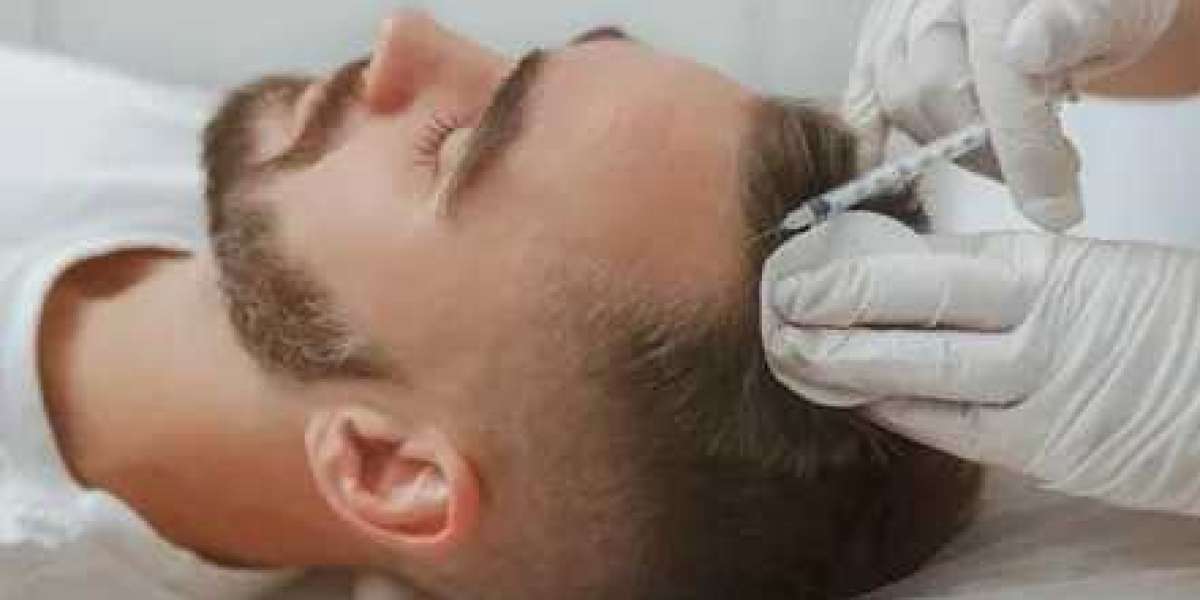 Advanced Hair Transplant Clinics in Islamabad