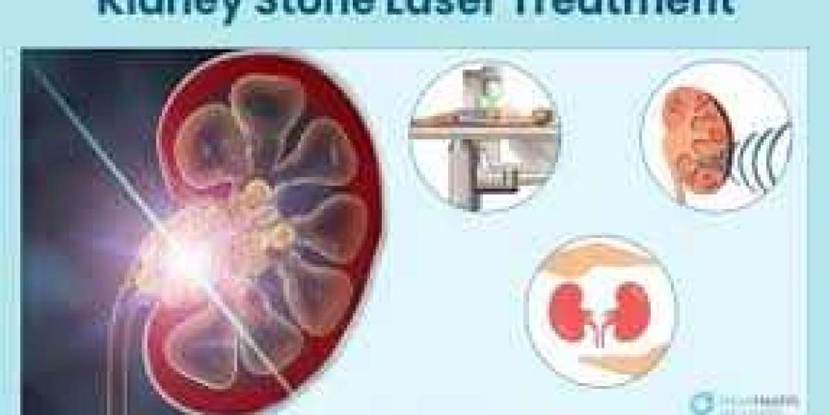 Kidney Stone Treatment: Complete Guide to Causes, Symptoms, and Solutions