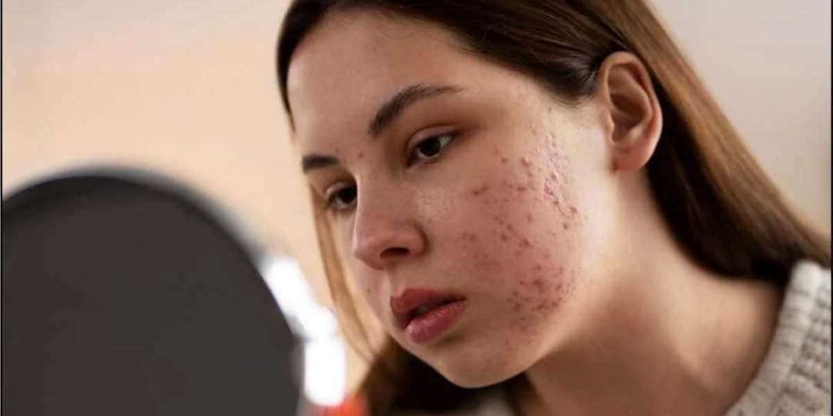 Skin Treatment in Delhi – Advanced Care at Aayna Clinic